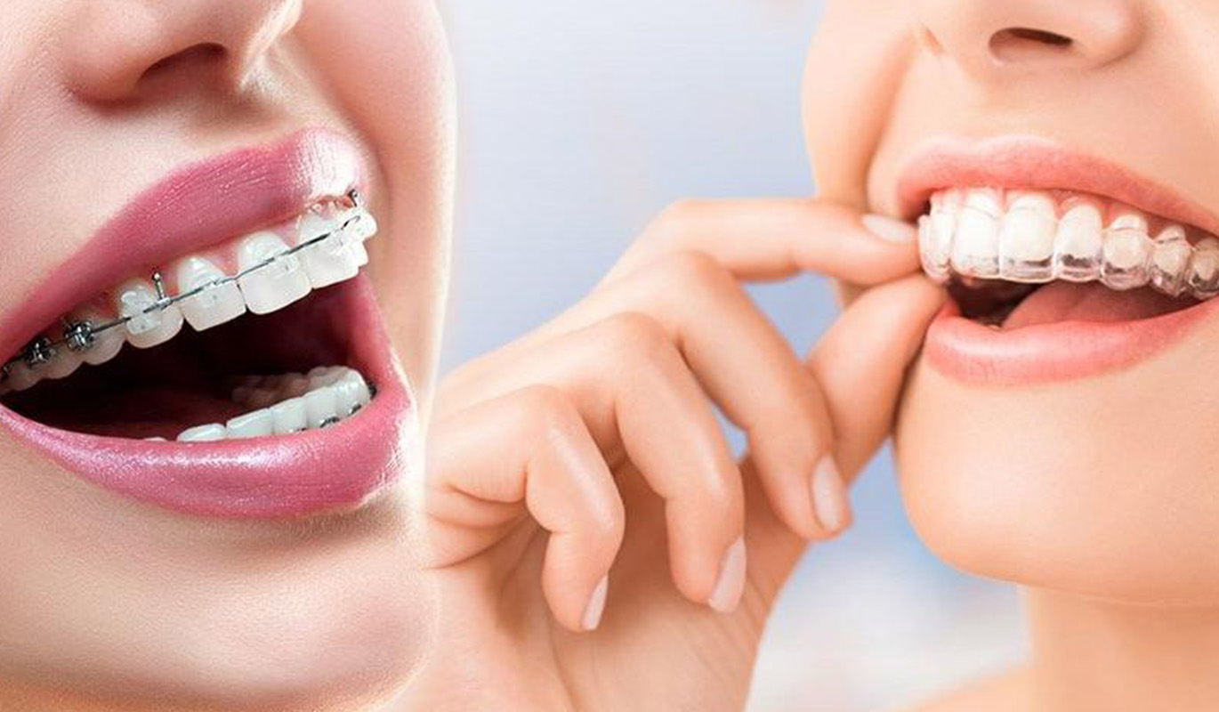 What Are Those Things In the Dentist’s Office